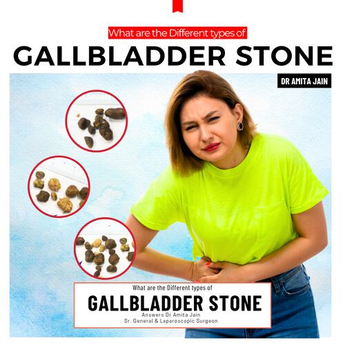 Dr Amita Jain Sr. General & Laparoscopic Surgeon for gallbladder stone in delhi