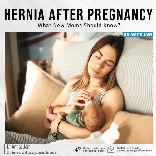 Dr Amita Jain best specialist doctor for Hernia Surgery post pregnancy in Delhi