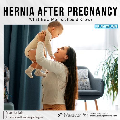Dr Amita Jain best specialist doctor for Hernia Surgery post pregnancy in Delhi