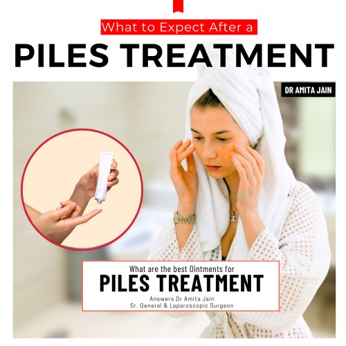 best creams for piles treatment by Dr Amita Jain