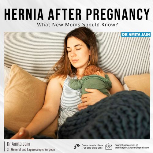 Dr Amita Jain best surgeon in Delhi for Hernia