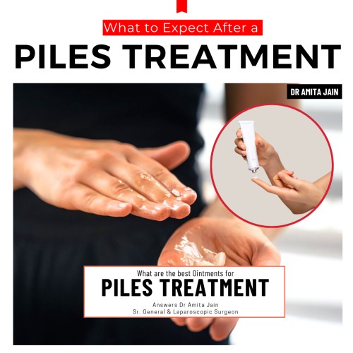 Dr Amita Jain surgeon for piles suggest best creams for piles treatment