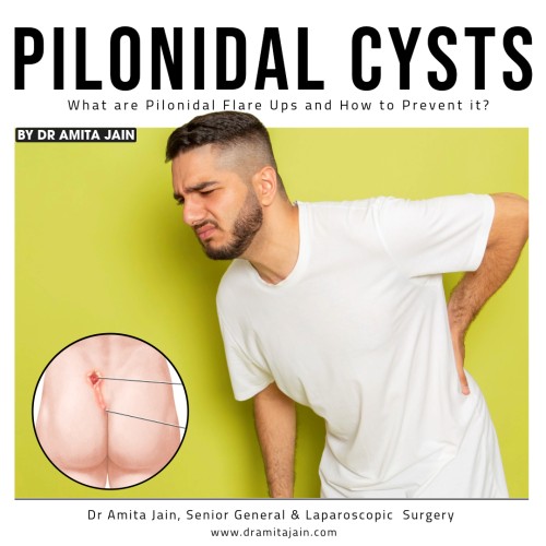 best Pilonidal Sinus doctor Dr Amita Jain