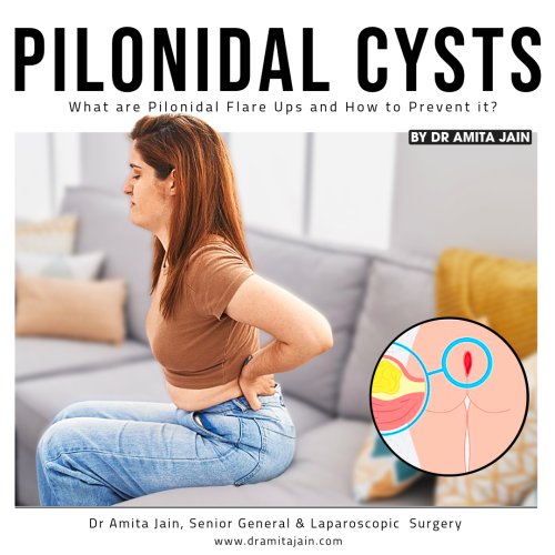 best Pilonidal Sinus treatment in Delhi by Dr Amita Jain