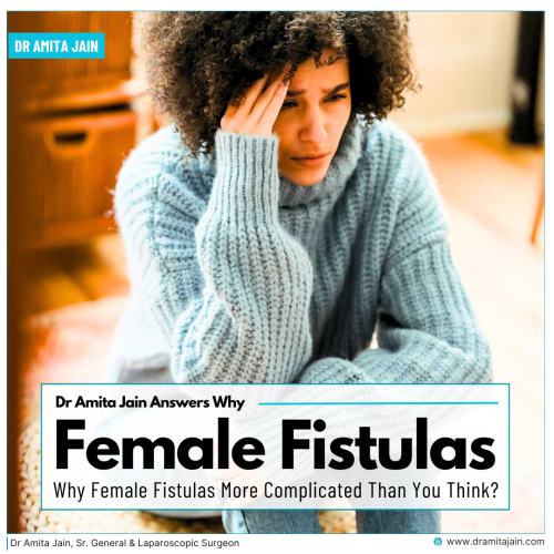 best Fistulas specialist doctor in Delhi Dr Amita Jain