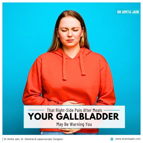 Dr Amita Jain Gallbladder stone removal surgeon in Delhi