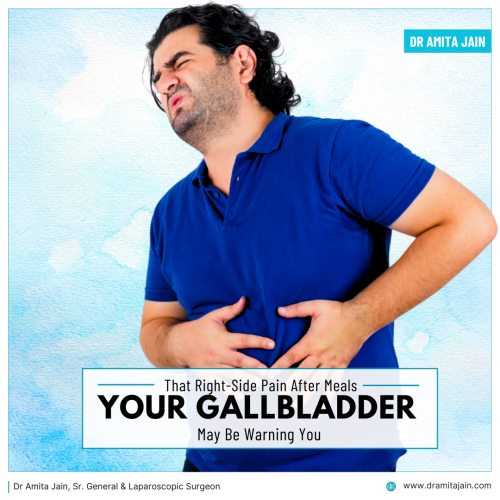 Dr Amita Jain Gallbladder stone removal surgeon in Delhi
