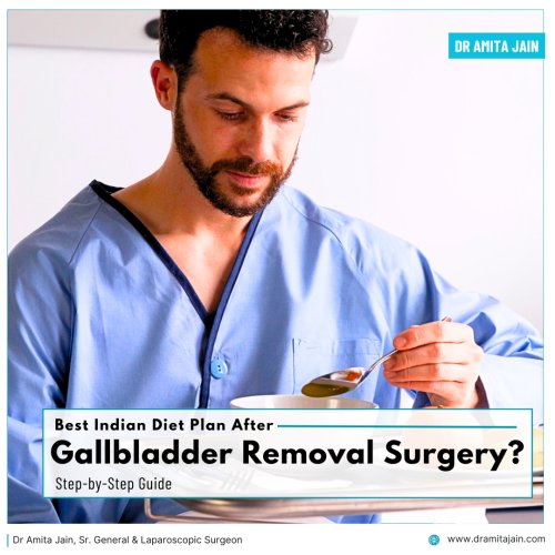 What Indian food to eat after Gallbladder Removal Surgery answers Dr Amita Jain