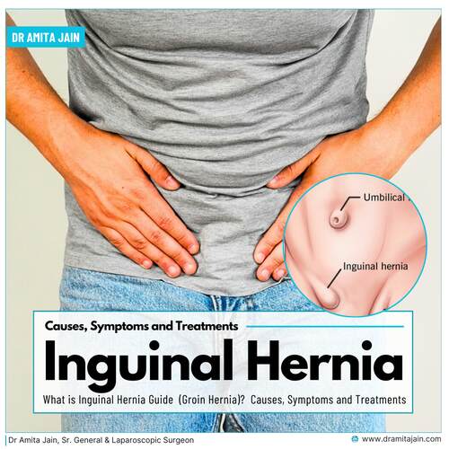 Dr Amita Jain_hernia surgeon delhi