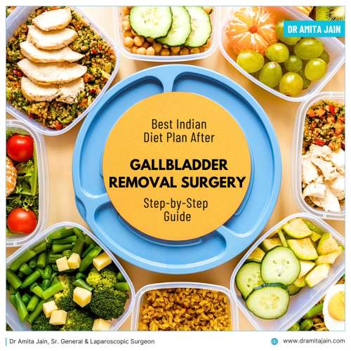 What Indian food to eat after Gallbladder Removal Surgery answers Dr Amita Jain
