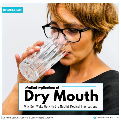 Reason for dry mouth by Dr Amita Jain Senior General Surgeon Delhi