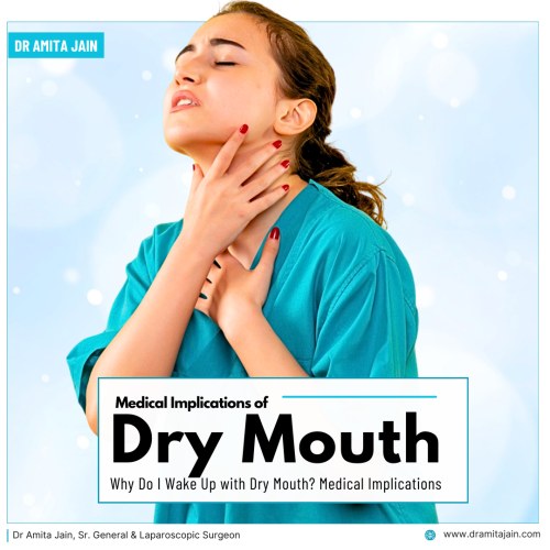 Reason for dry mouth by Dr Amita Jain Senior General Surgeon Delhi