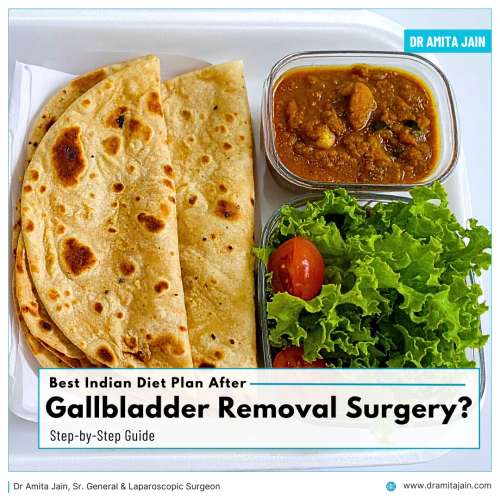 What Indian food to eat after Gallbladder Removal Surgery answers Dr Amita Jain
