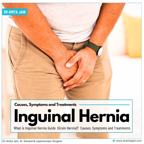 best hernia surgeon in delhi_dr amita jain