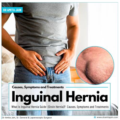 best inguinal hernia surgeon in delhi_dr amita jain