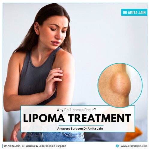 Delhi's top lipoma surgeon_Dr amita jain
