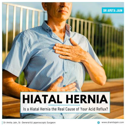 Dr Amita Jain General Surgeon for Hernia surgery in Delhi