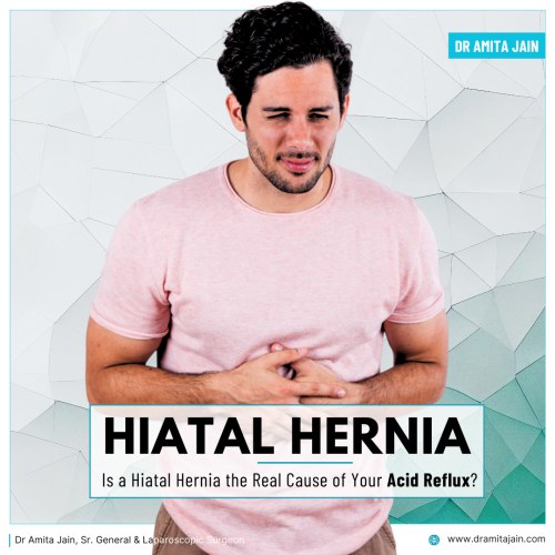 Dr Amita Jain the best hernia surgeon in Delhi 