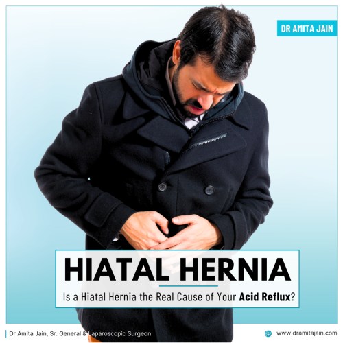 Dr Amita Jain the best hernia surgeon in Delhi 