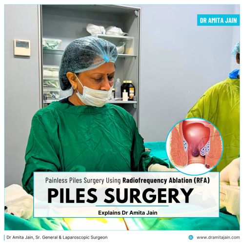 Dr Amita Jain Painless Piles Surgery Radiofrequency Ablation