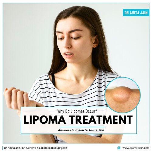 Dr Amita Jain Sr. General & Laparoscopic Surgeon, lipoma specialist_delhi
