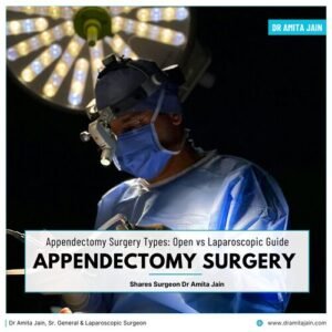 Open or Laparoscopic Appendectomy: What’s the Difference?