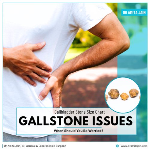 Dr Amita Jain best gallbladder stone removal surgeon in Delhi India
