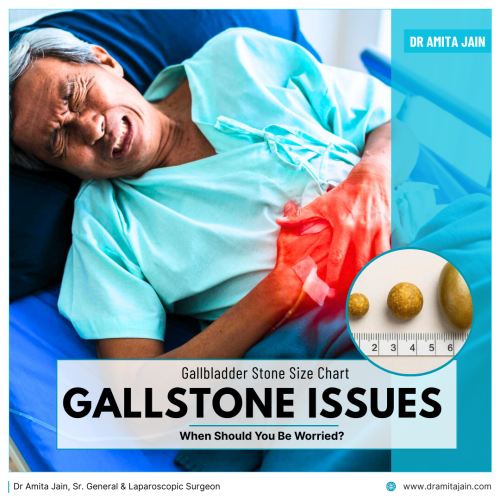 Dr Amita Jain, who is a senior general and laparoscopic surgeon and one of the leading gallstone removal surgeons in Delhi and India