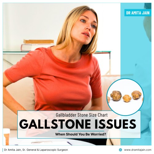 Dr Amita Jain, who is a senior general and laparoscopic surgeon and one of the leading gallstone removal surgeons in Delhi and India