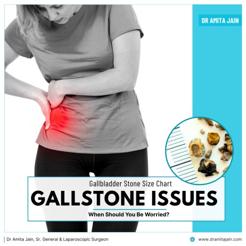 Dr Amita Jain, who is a senior general and laparoscopic surgeon and one of the leading gallstone removal surgeons in Delhi and India