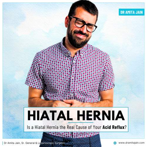 Dr Amita Jain the best hernia surgeon in Delhi 