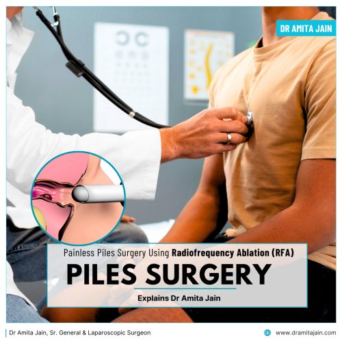 Dr Amita Jain Painless Piles Surgery Radiofrequency Ablation