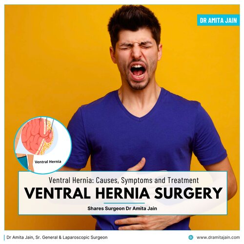 Dr Amita Jain Sr. General & Laparoscopic Surgeon_best ventral hernia surgeon in delhi