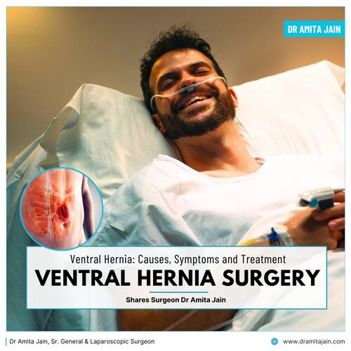 Dr Amita Jain Sr. General & Laparoscopic Surgeon_leading surgeon for ventral hernia in delhi