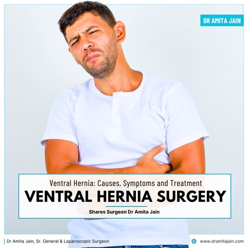 Dr Amita Jain Sr. General & Laparoscopic Surgeon_ventral hernia specialist in delhi
