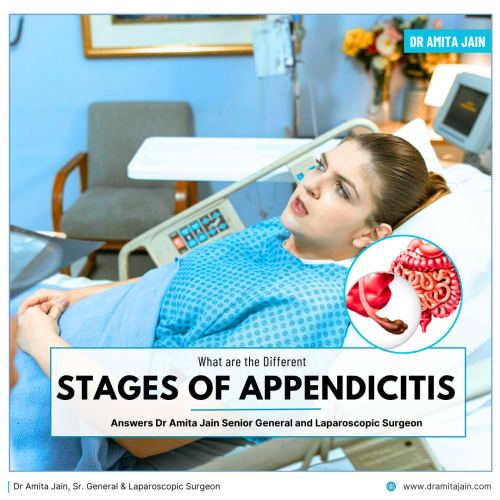 Dr Amita Jain best surgeon for appendicitis in Delhi