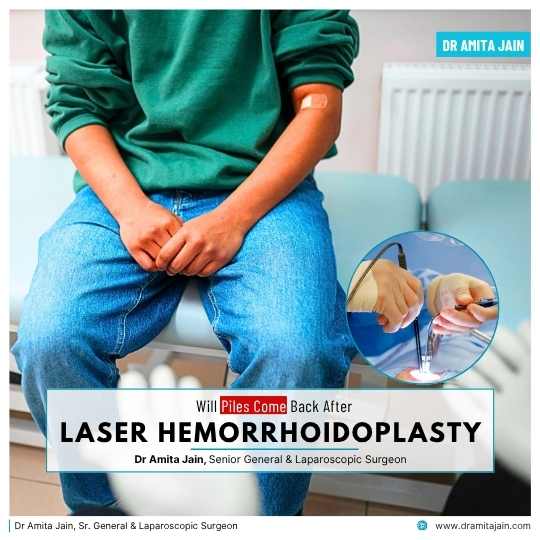 Laser Piles Surgery Treatment in Delhi