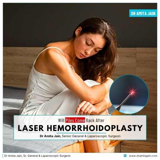 Laser Piles Surgery Treatment in Delhi