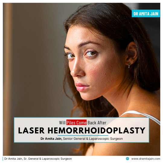 Laser Piles Surgery Treatment in Delhi