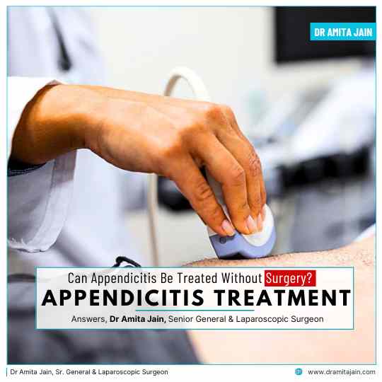 Can Appendicitis Be Treated Without Surgery Answears Dr Amita Jain Senior General and Laparoscopic Surgeon