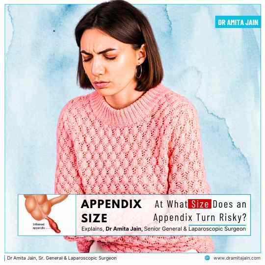 Dr Amita Jain Sr. General & Laparoscopic Surgeon for appendix surgery in delhi
