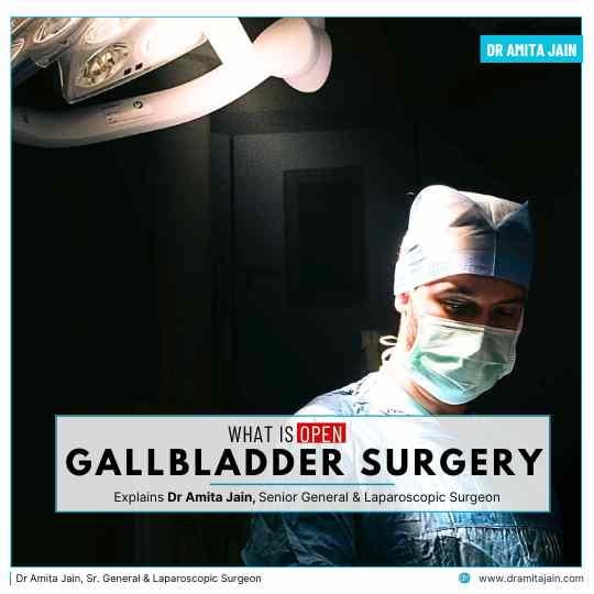 Open Gallbladder Surgery in Delhi by Dr Amita Jain Senior General Laparoscopic Surgeon