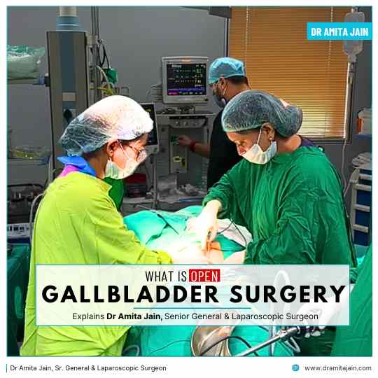 Open Gallbladder Surgery in Delhi by Dr Amita Jain Senior General Laparoscopic Surgeon