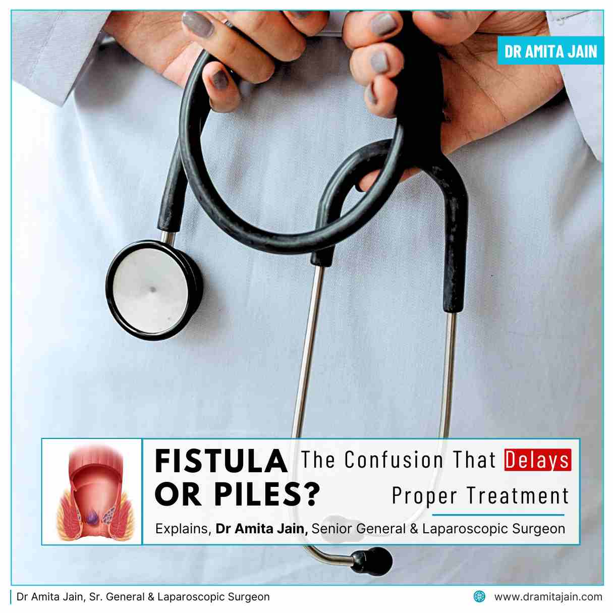 Painless Fistula and Piles Surgery in Delhi by Dr Amita Jain