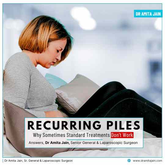 Recurring Piles treatment and surgery in Delhi by Dr Amita Jain 