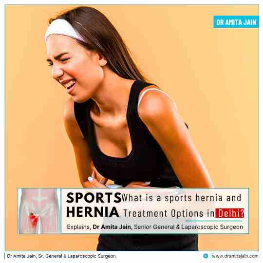Sports Hernia and Treatment Options in Delhi
