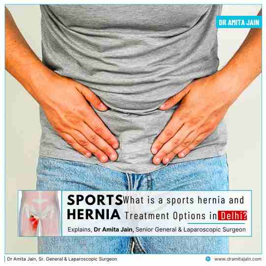 Sports Hernia and Treatment Options in Delhi
