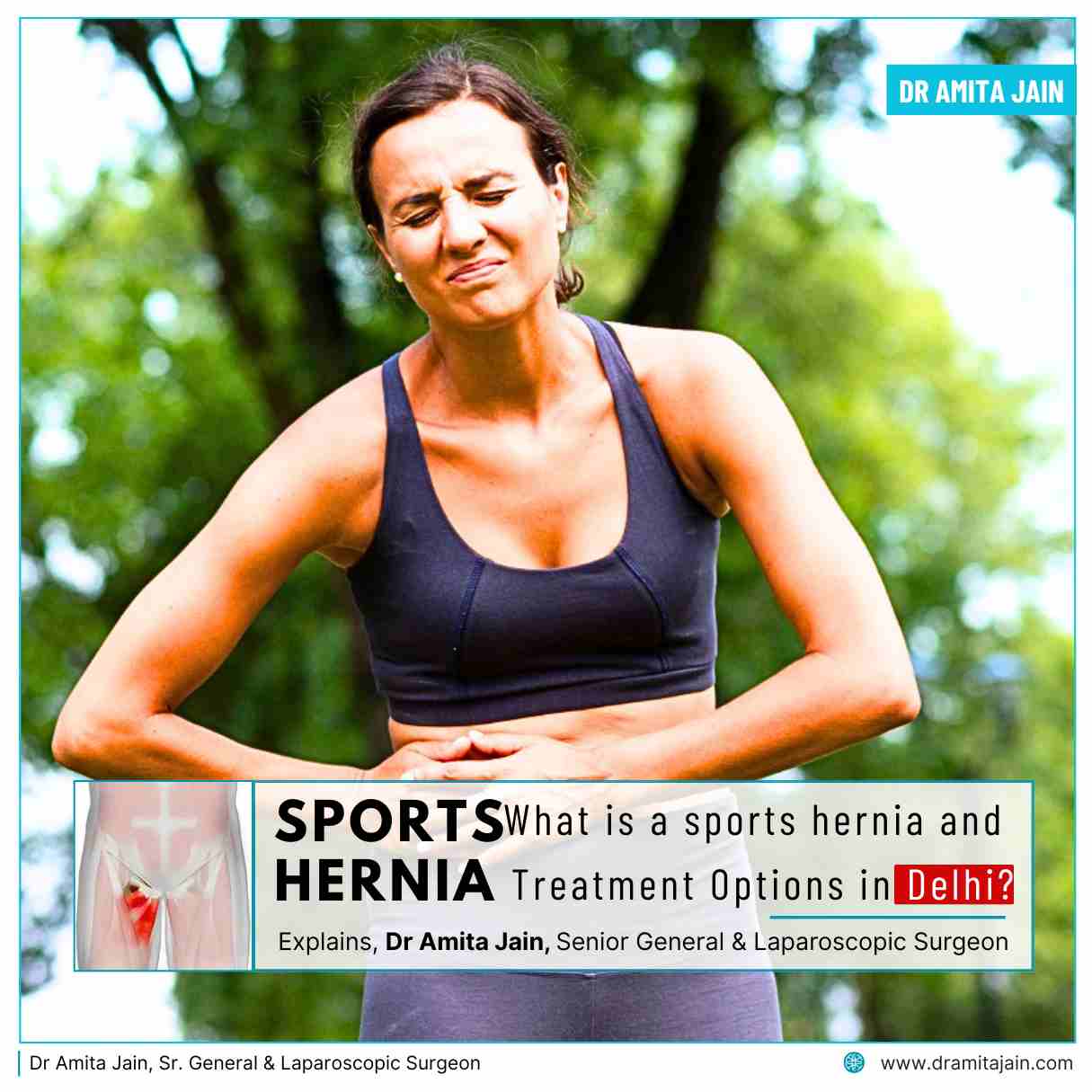 Sports Hernia and Treatment Options in Delhi Dr Amita Jain