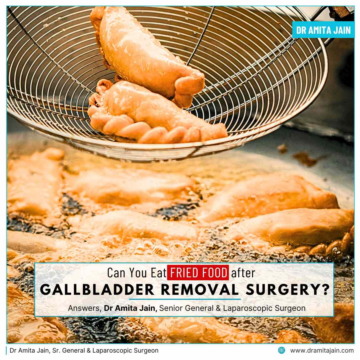 Can You Eat Fried Food After Gallbladder Removal Surgery