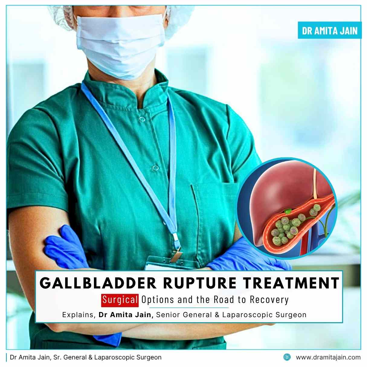 Dr Amita Jain Sr. General & Laparoscopic Surgeon for gallbladder in delhi